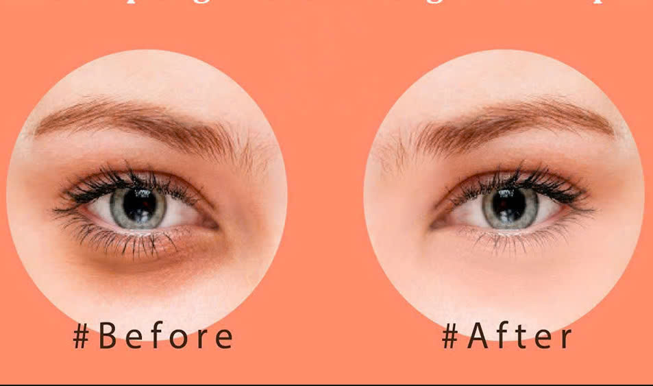 Share the fastest way to remove dark circles under the eyes with photoshop