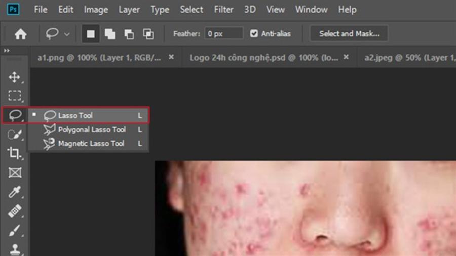 2-ways-to-remove-acne-in-photoshop.jpg
