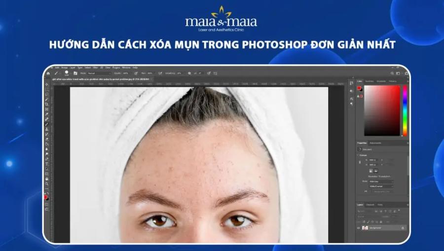 3-ways-to-remove-acne-in-photoshop.jpg
