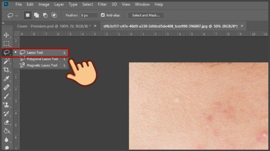 1-cach-xoa-mun-trong-photoshop.jpg