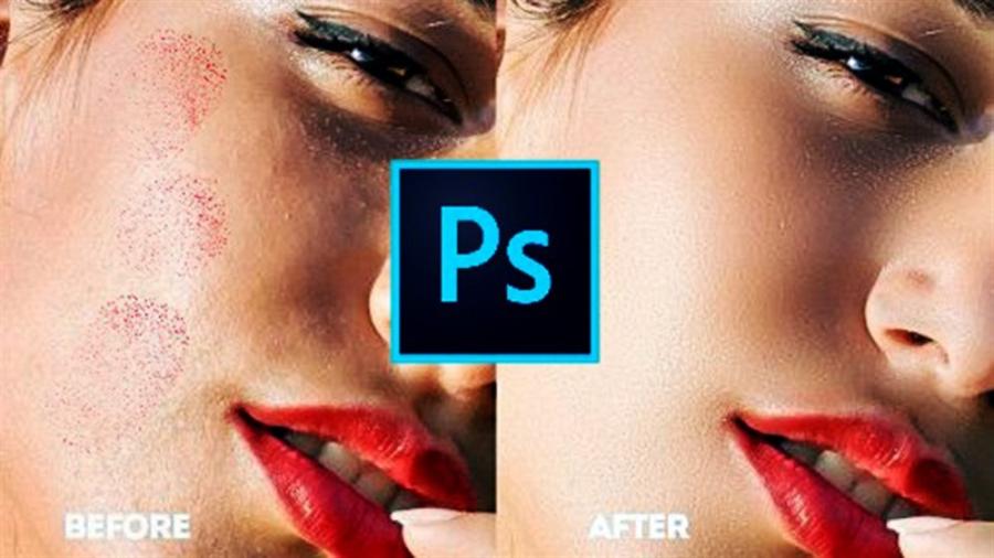 4-ways-to-remove-acne-in-photoshop.jpg