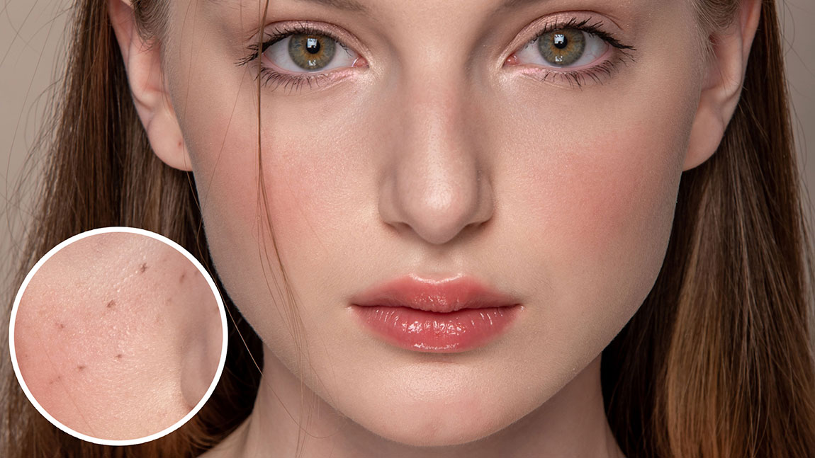 High End Skin Retouching in Photoshop