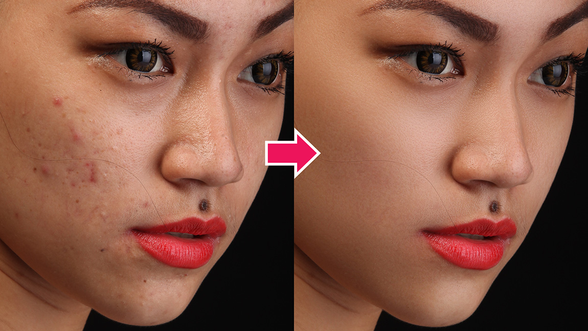 How To Manually Treat Skin Using Photoshop